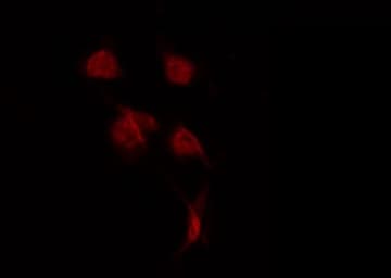 USP42 Antibody