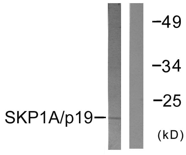SKP1 Antibody