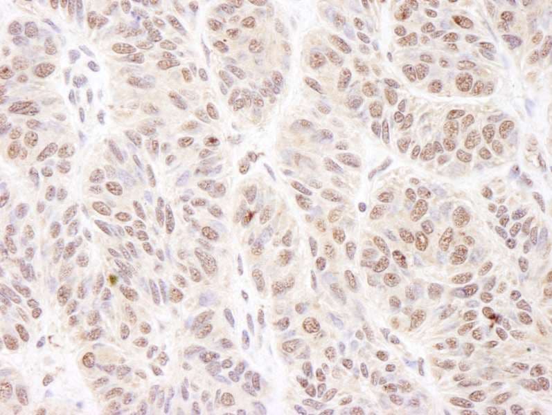 BTF / BCLAF1 Antibody (aa875-C-term)