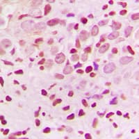 ZNF174 Antibody (Internal)