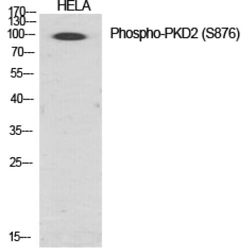 Polyclonal Rabbit anti-Human PRKD2 / PKD2 Antibody (810-890 aa, IHC, WB)