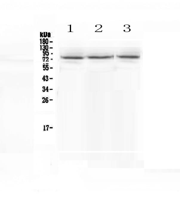 Polyclonal Rabbit anti-Human SCNN1A / ENaC Alpha Antibody (WB)