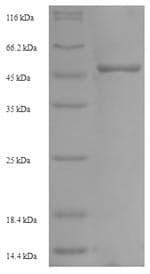 Mouse NKX2-2 Protein (Recombinant 6His-SUMO, N-terminus)