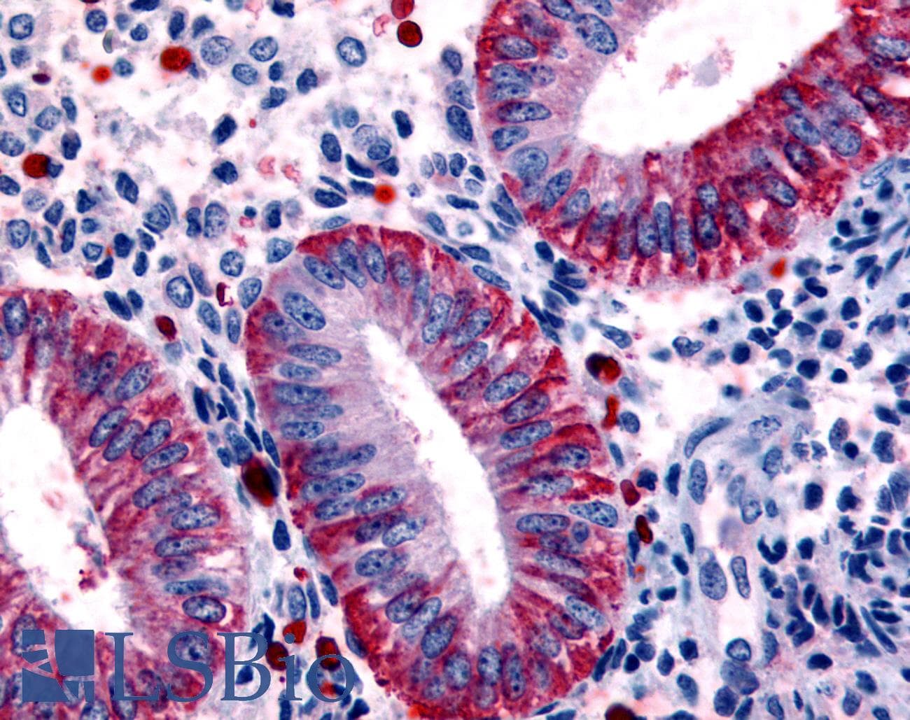 IHC-plus™ DKK1 Antibody (Internal)