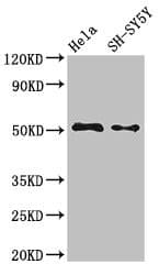 Polyclonal Rabbit anti-Human FADS1 Antibody (IHC, IF)