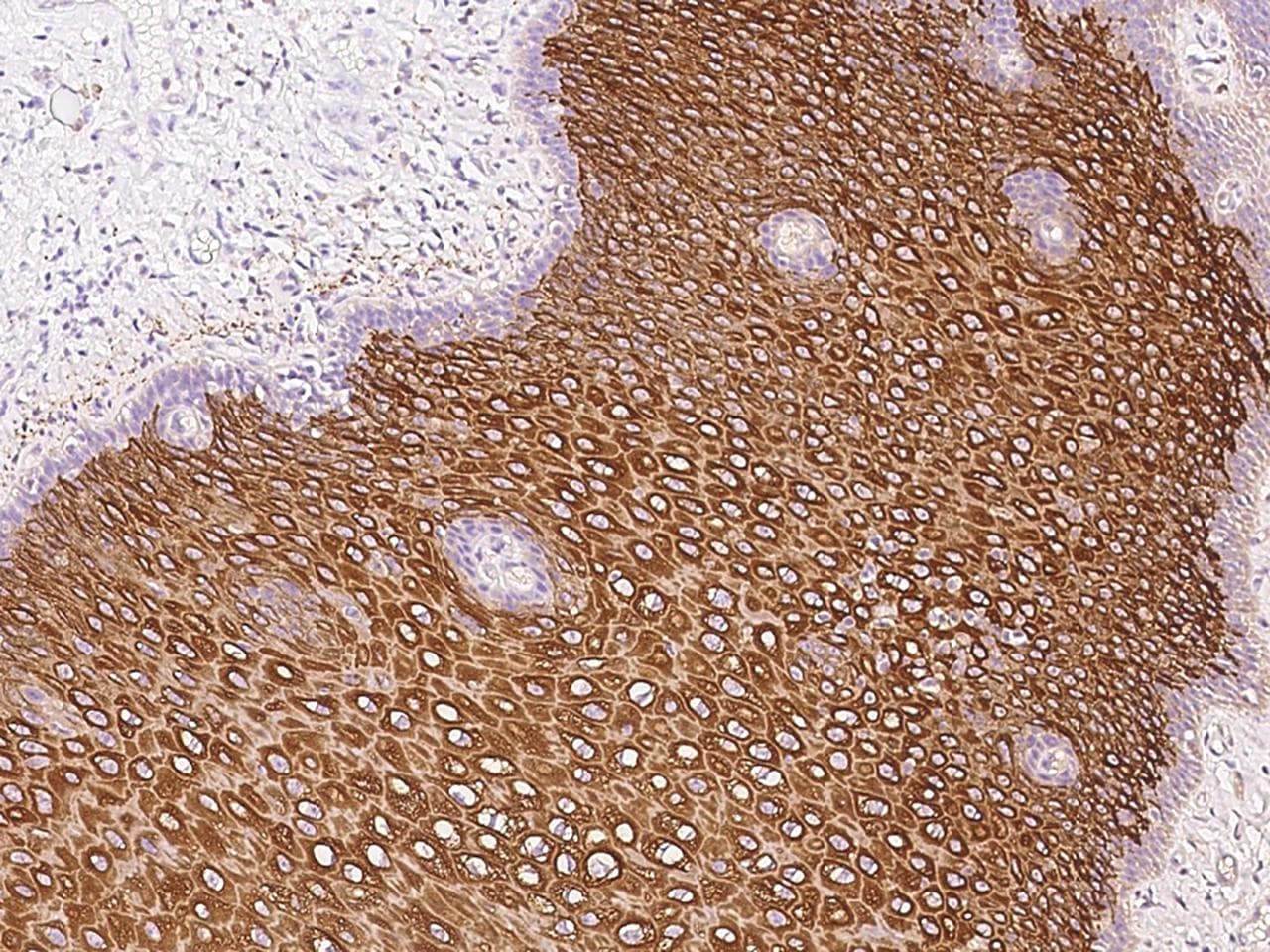KRT6A / CK6A / Cytokeratin 6A Antibody