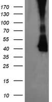 MAP2K3 / MEK3 / MKK3 Antibody (clone OTI5F2)