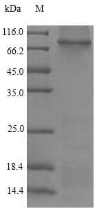 Rat ITGB4 / Integrin Beta 4 Protein (Recombinant 6His, N-terminus)