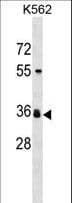 SLC25A2 Antibody (aa78-107)