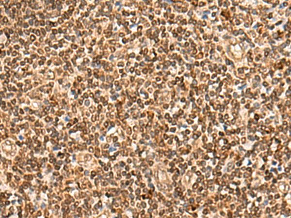 HOXC12 Antibody