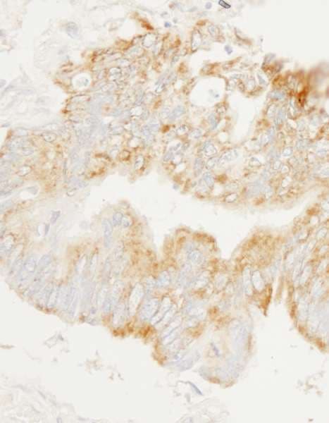 ARHGEF2 / GEF-H1 Antibody (aa625-675)
