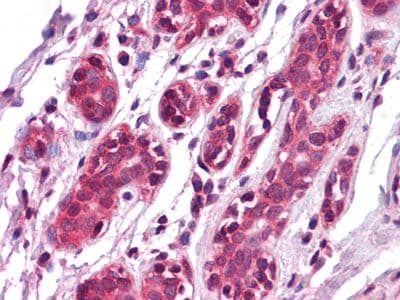 EPHA7 / EPH Receptor A7 Antibody (Amino Acid: 27-210, clone 6C8G7)