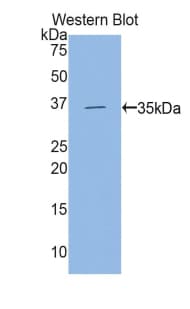 HK2 / Hexokinase 2 Antibody (aa619-917)