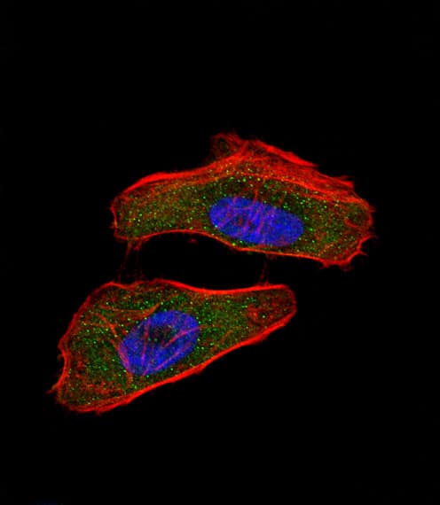 Polyclonal Rabbit anti-Human HIF1A / HIF1 Alpha Antibody (aa1-30, IHC, IF, WB)
