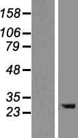 TMEM106B Protein (Over-Expression Lysate Myc-DDK (Flag))