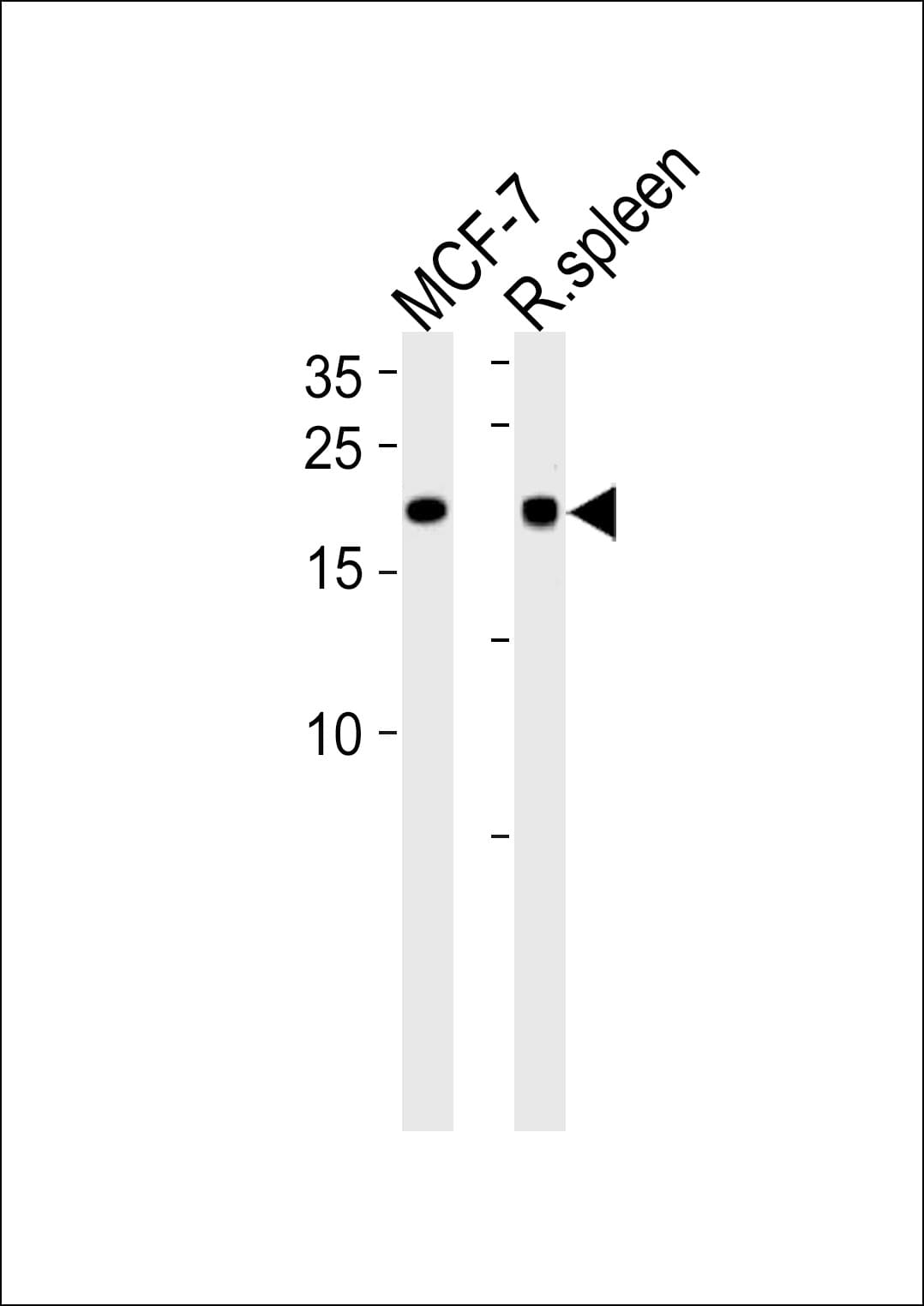 CNBP / ZNF9 Antibody (aa91-118)