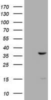 TS / Thymidylate Synthase Antibody (clone OTI9H4)