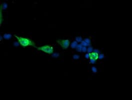 MAP2K3 / MEK3 / MKK3 Antibody (clone OTI5F9)