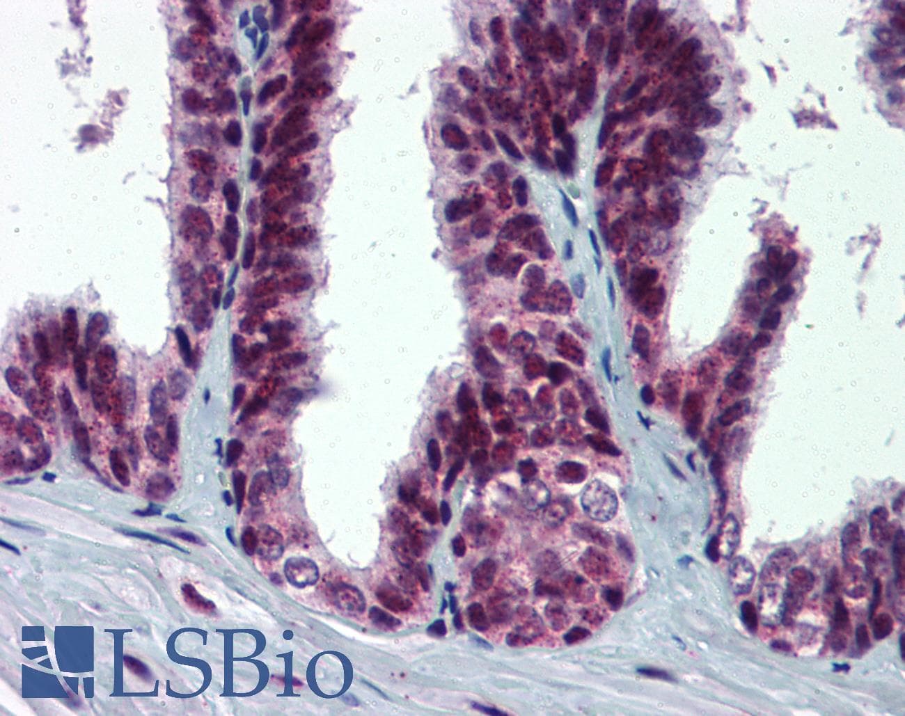 IHC-plus™ MDM2 Antibody (phospho-Ser395)