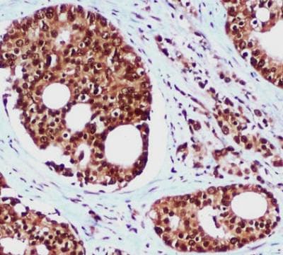 Monoclonal Mouse anti-Human RAD23B / HR23B Antibody (IHC, WB)