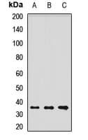 EPM2A / Laforin Antibody