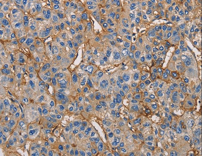 ICAM-1 / CD54 Antibody
