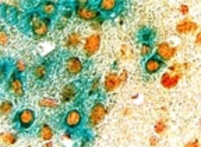 Cre Recombinase Antibody