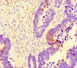 SYT10 / Synaptotagmin X Antibody