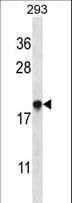 TMEM85 Antibody (aa34-62)