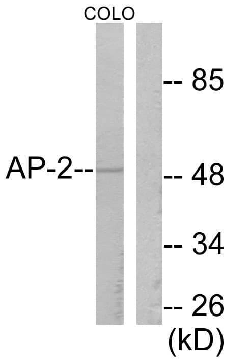 IHC-plus™ AP-2 Alpha/Beta Antibody (aa388-437)
