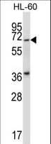 PKMYT1 Antibody (aa114-143)