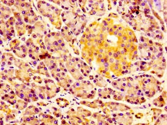 Polyclonal Rabbit anti-Human ERGIC2 Antibody (IHC, IF, WB)