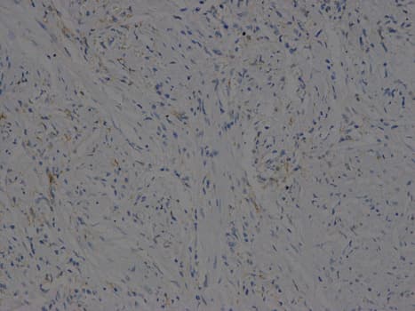 VEGFB Antibody