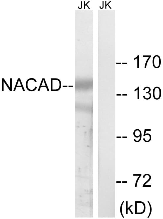 Polyclonal Rabbit anti-Human NACAD Antibody (aa376-425, WB)