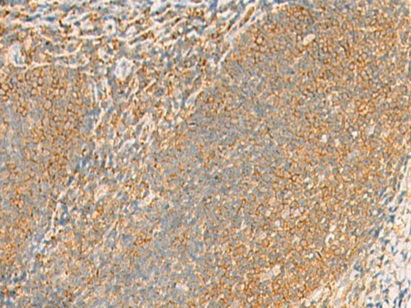 GRIA4 / GLUR4 Antibody