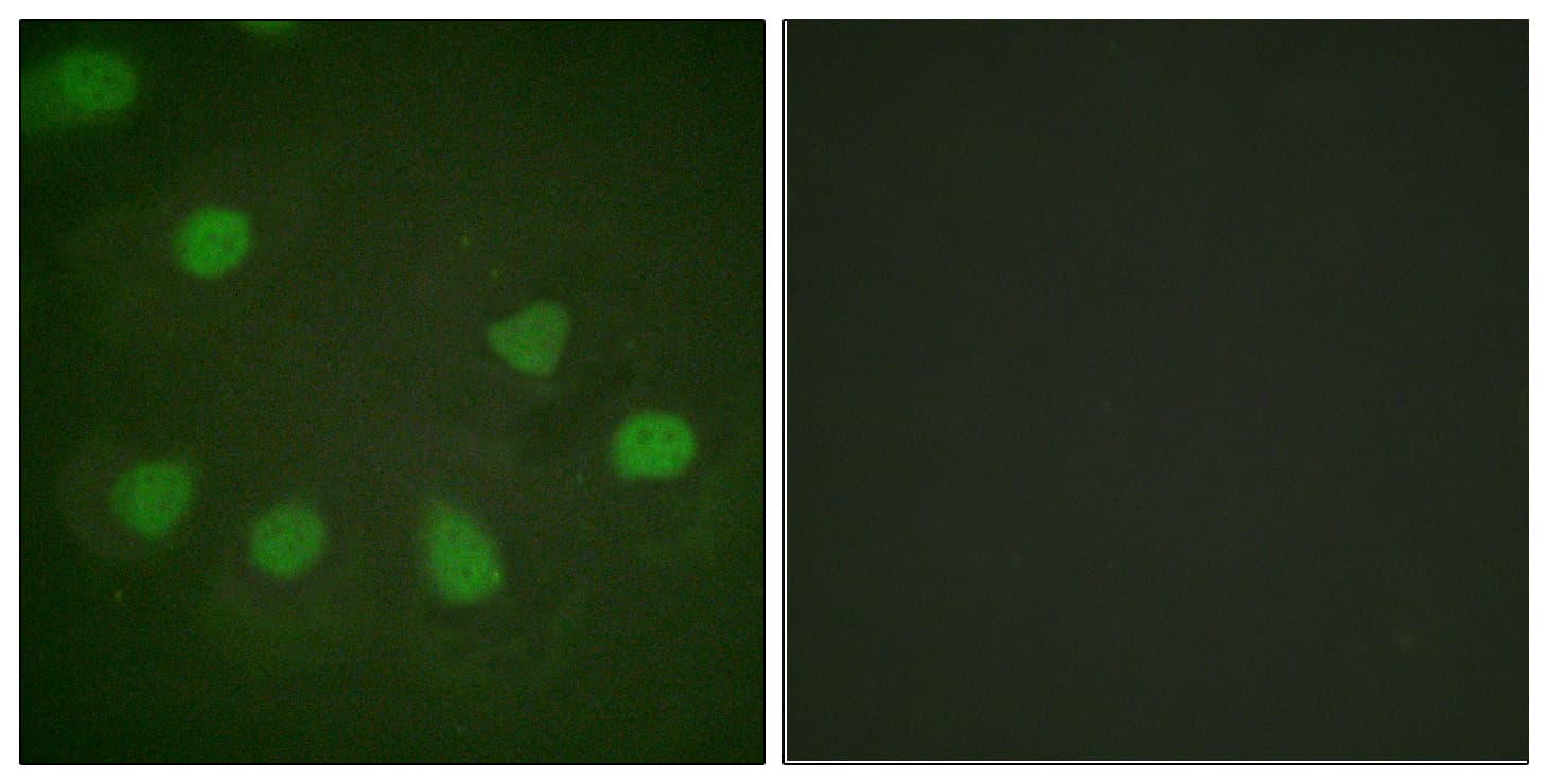 Polyclonal Rabbit anti-Human RB1 / Retinoblastoma / RB Antibody (aa211-260, IHC, IF)