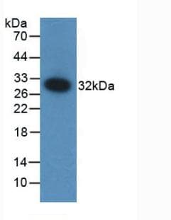F12 / Factor XII Antibody (aa352-587)