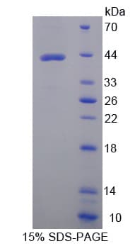 Human GOT2 Protein (Recombinant His)