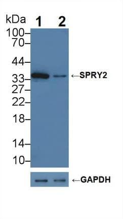 SPRY2 / Sprouty 2 Antibody (aa116-305)