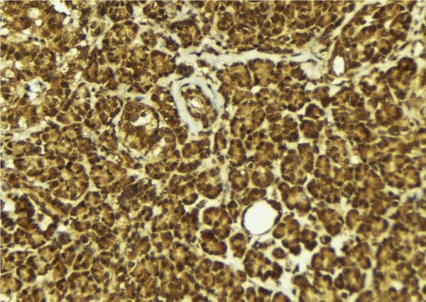 NEIL2 Antibody