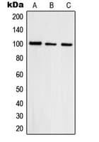 Polyclonal Rabbit anti-Human TOP3B Antibody (N-Terminus, IHC, WB)