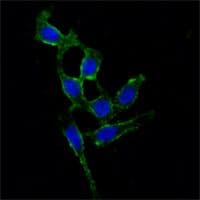 FAK / Focal Adhesion Kinase Antibody (clone 10H7E9)