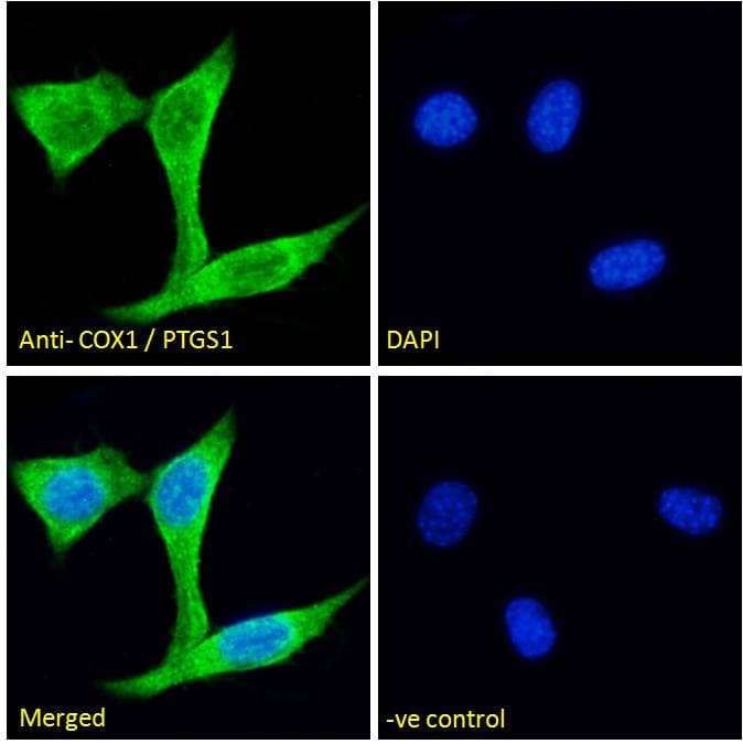 IHC-plus™ PTGS1 / COX-1 Antibody (aa617-630)