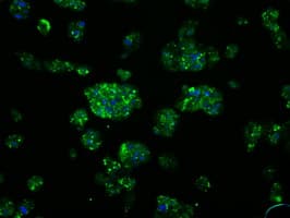 SRR / Serine Racemase Antibody (clone OTI7E8, Carrier-free)