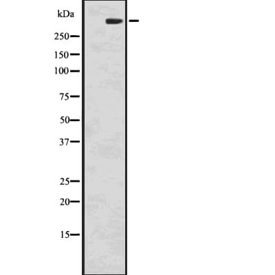 Polyclonal Rabbit anti-Human ITPR1 / IP3 Receptor Type 1 Antibody (WB)