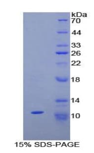 Rat Neuropeptide S / NPS Protein (Recombinant His-T7)