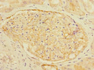 Polyclonal Rabbit anti-Human CR1 / CD35 Antibody (aa420-550, IHC, WB)