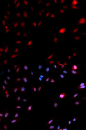 CDK1 / CDC2 Antibody (phospho-Tyr15)