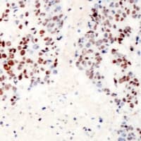 Polyclonal Rabbit anti-Human ATF2 Antibody (N-Terminus, IHC, WB)