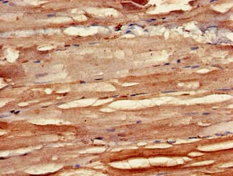 Polyclonal Rabbit anti-Human ALK-6 / BMPR1B Antibody (IHC, IF, WB)